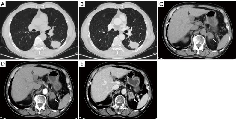 https://cdn.ncbi.nlm.nih.gov/pmc/blobs/0a00/12332602/8ba5cc75c074/qims-15-08-6787-f4.jpg
