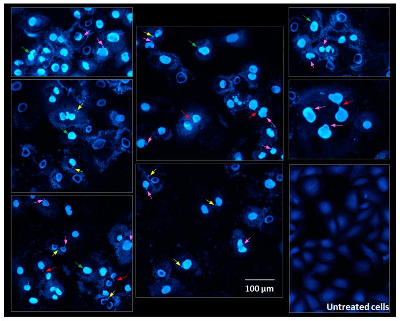 https://cdn.ncbi.nlm.nih.gov/pmc/blobs/0a03/10343249/41b4c9cfc81f/molecules-28-05064-g014.jpg