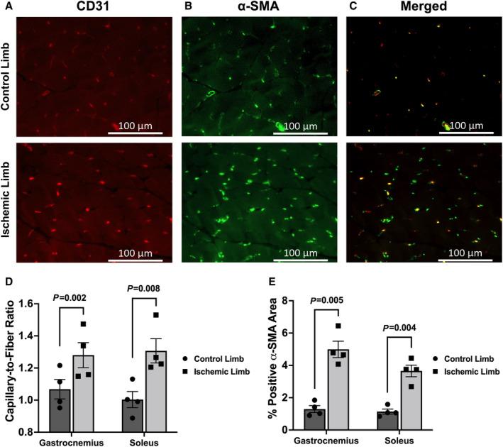 https://cdn.ncbi.nlm.nih.gov/pmc/blobs/0a0e/11010069/32e9da14ad10/JAH3-13-e031823-g002.jpg