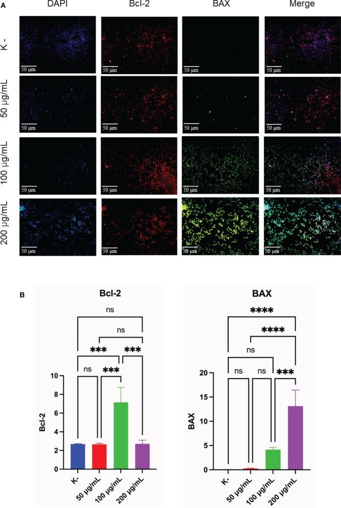 https://cdn.ncbi.nlm.nih.gov/pmc/blobs/0a10/9530281/5742365048d4/fonc-12-964816-g004.jpg