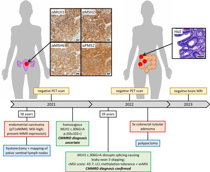 https://cdn.ncbi.nlm.nih.gov/pmc/blobs/0a12/11126593/6483eed2a5b8/41698_2024_603_Fig3_HTML.jpg