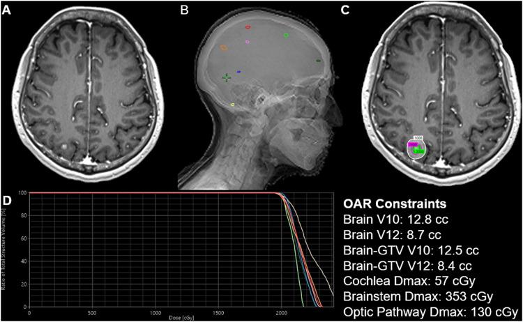 https://cdn.ncbi.nlm.nih.gov/pmc/blobs/0a17/10823095/37d50e55aeaf/gr1.jpg