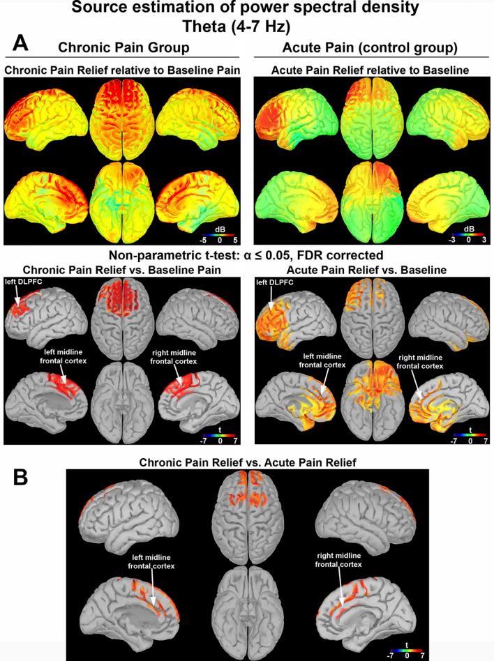 https://cdn.ncbi.nlm.nih.gov/pmc/blobs/0a1b/9555895/bf7e50b3a0e0/painreports-7-e1040-g007.jpg