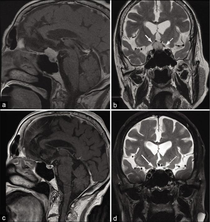 https://cdn.ncbi.nlm.nih.gov/pmc/blobs/0a27/7771486/364098f0768a/SNI-11-458-g003.jpg