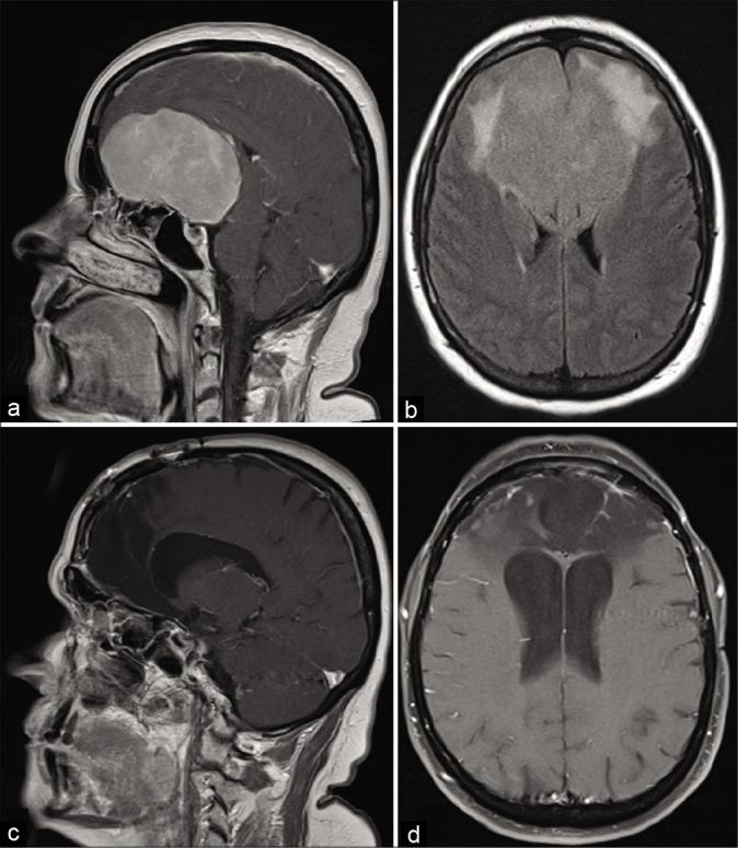 https://cdn.ncbi.nlm.nih.gov/pmc/blobs/0a27/7771486/4510c4f50fff/SNI-11-458-g004.jpg