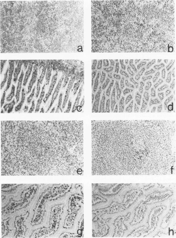 https://cdn.ncbi.nlm.nih.gov/pmc/blobs/0a28/1861642/f54b6da62f90/amjpathol00042-0323-a.jpg