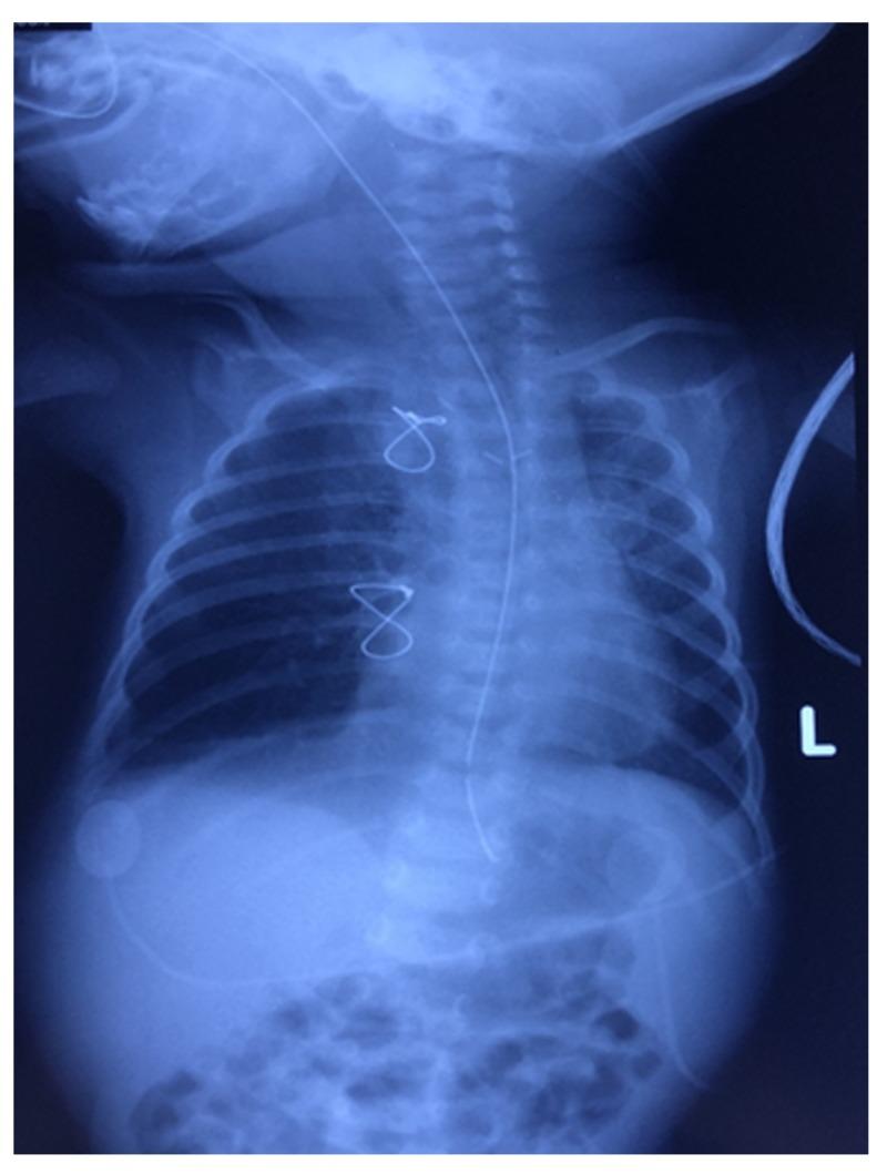 https://cdn.ncbi.nlm.nih.gov/pmc/blobs/0a28/7058402/65961915b5b4/cureus-0012-00000006889-i03.jpg
