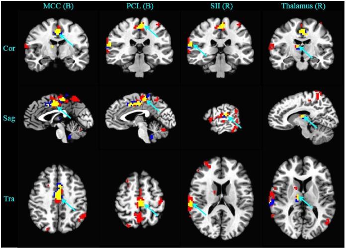 https://cdn.ncbi.nlm.nih.gov/pmc/blobs/0a2a/4018444/76704b9e42b0/pone.0097502.g003.jpg