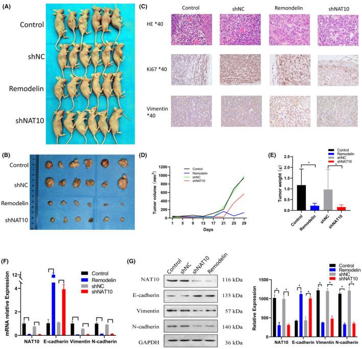 https://cdn.ncbi.nlm.nih.gov/pmc/blobs/0a2c/11145023/fb3f252555aa/CAM4-13-e7283-g002.jpg