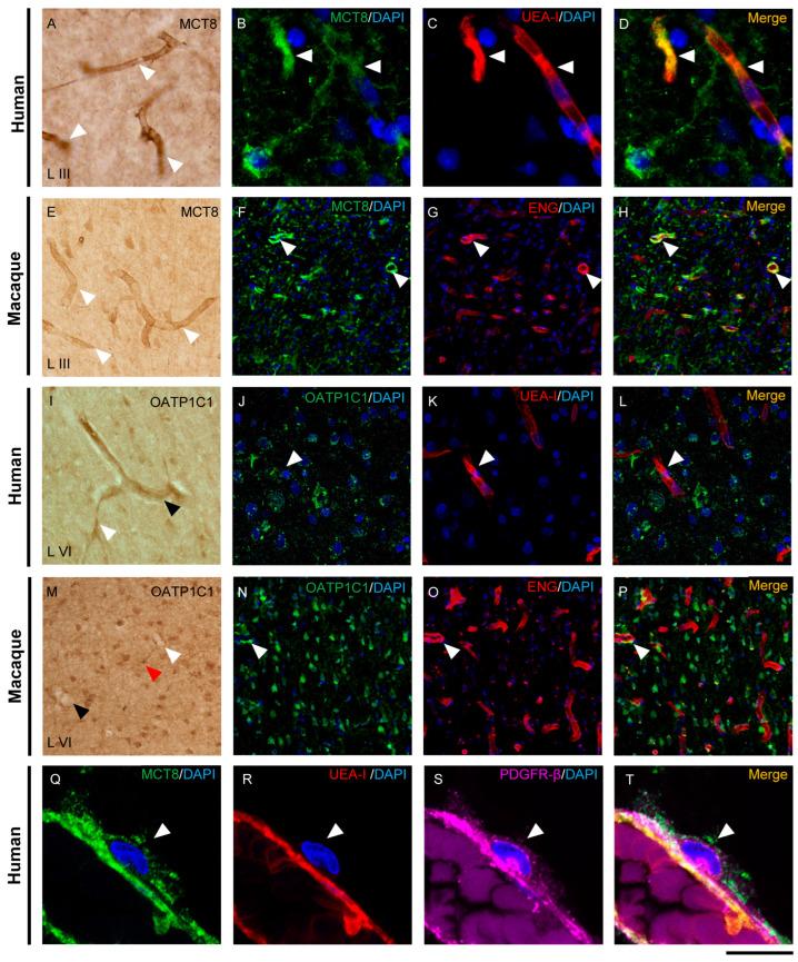 https://cdn.ncbi.nlm.nih.gov/pmc/blobs/0a30/9965431/40b018051aaa/ijms-24-03207-g002.jpg