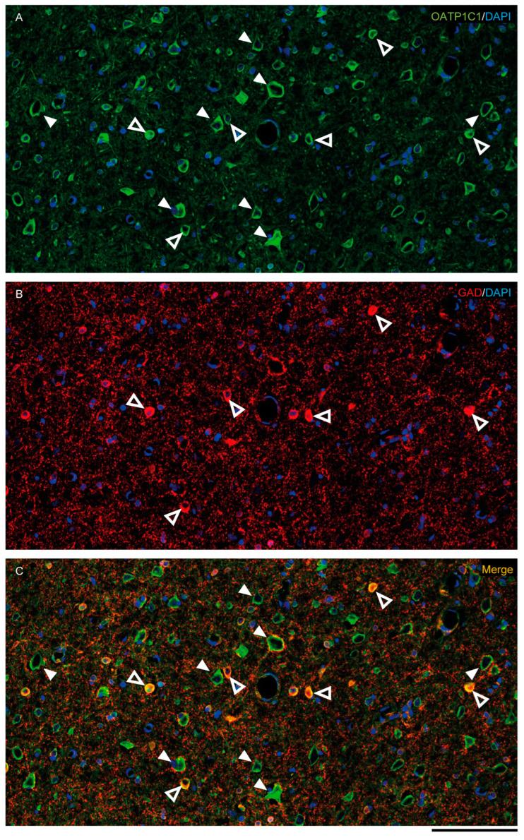https://cdn.ncbi.nlm.nih.gov/pmc/blobs/0a30/9965431/5ea4fb4db9ad/ijms-24-03207-g005.jpg