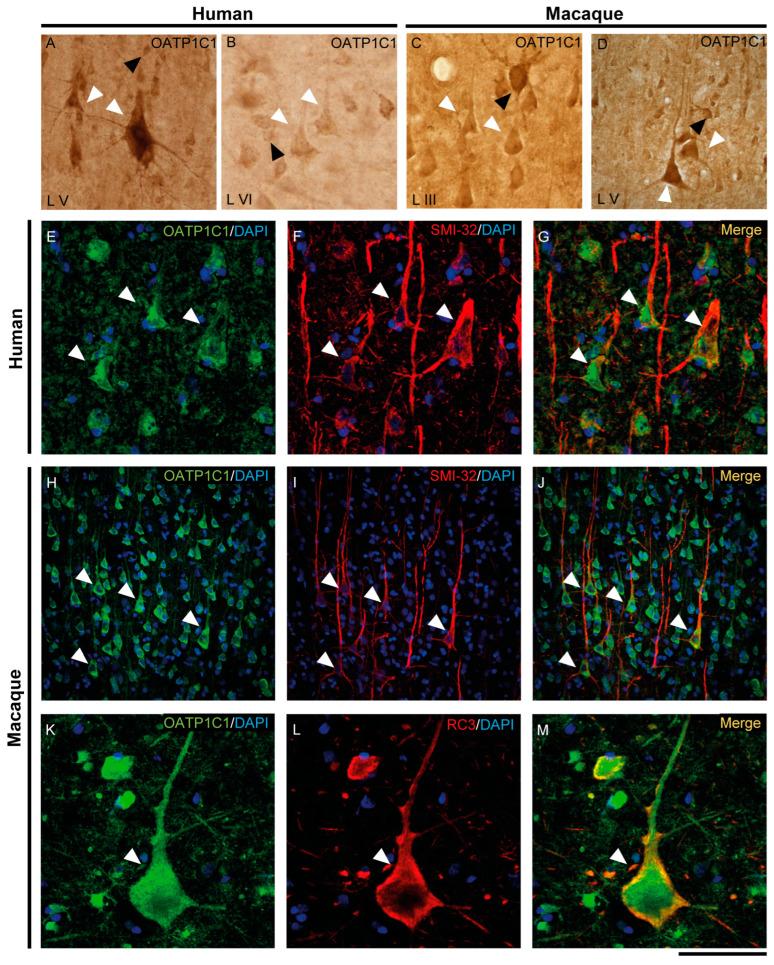 https://cdn.ncbi.nlm.nih.gov/pmc/blobs/0a30/9965431/c3c4f9d6f6ee/ijms-24-03207-g004.jpg