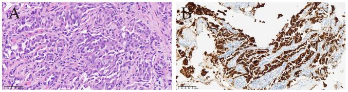 https://cdn.ncbi.nlm.nih.gov/pmc/blobs/0a35/12278715/76bdb3ed928a/ol-30-03-15178-g02.jpg
