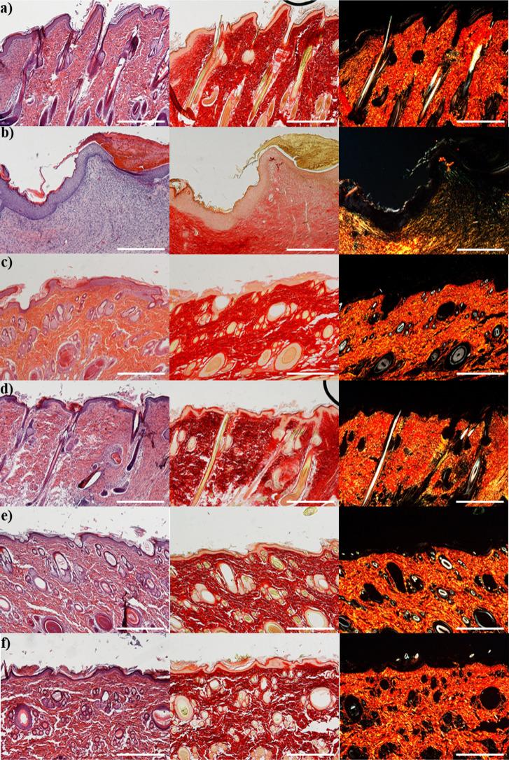 https://cdn.ncbi.nlm.nih.gov/pmc/blobs/0a3b/10251353/9fcff86f4219/am3c06144_0008.jpg