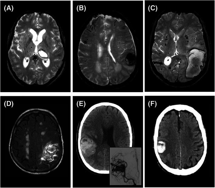 https://cdn.ncbi.nlm.nih.gov/pmc/blobs/0a44/10099946/f565b088c5ed/ANA-93-16-g001.jpg