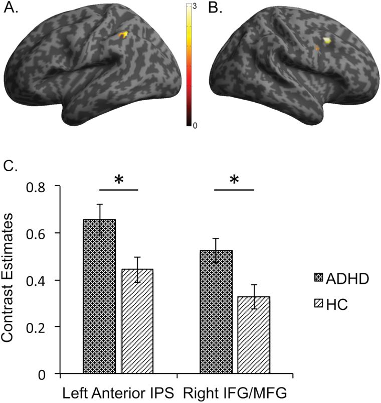 https://cdn.ncbi.nlm.nih.gov/pmc/blobs/0a4e/5091824/46c3d2762c5d/ijnppy_pyw049_f0003.jpg