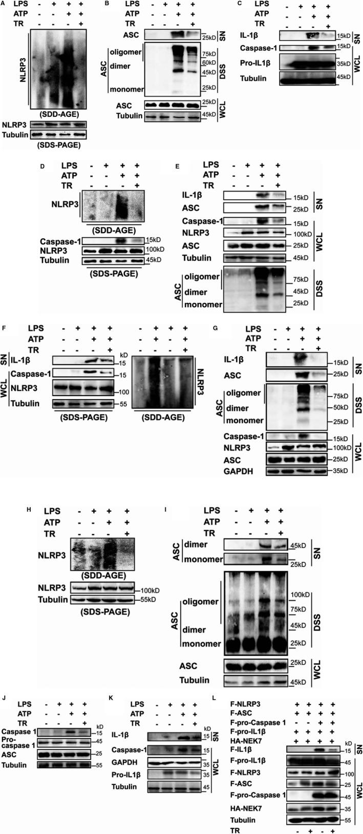 https://cdn.ncbi.nlm.nih.gov/pmc/blobs/0a50/7429049/9568f716d0db/JAH3-9-e015513-g003.jpg