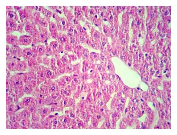 https://cdn.ncbi.nlm.nih.gov/pmc/blobs/0a5a/3432555/3e09b7b8ab73/ECAM2012-740671.015.jpg