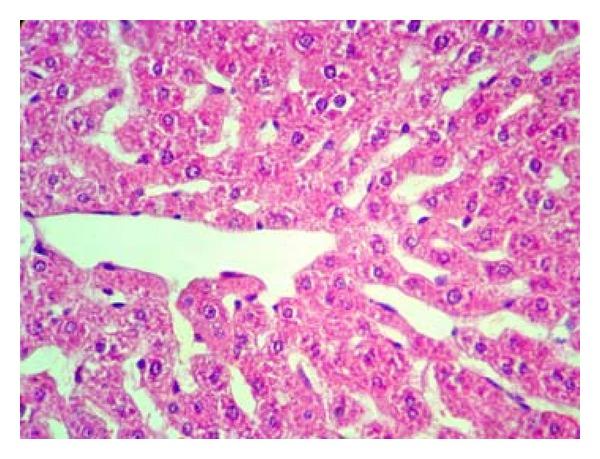 https://cdn.ncbi.nlm.nih.gov/pmc/blobs/0a5a/3432555/57f6b79c1949/ECAM2012-740671.013.jpg