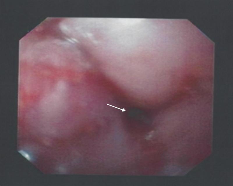 https://cdn.ncbi.nlm.nih.gov/pmc/blobs/0a5a/7437138/0eb214af9db3/cureus-0012-00000009284-i01.jpg