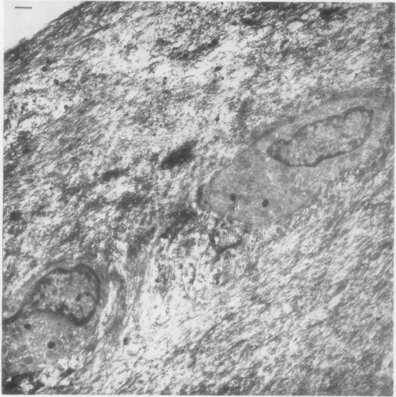 https://cdn.ncbi.nlm.nih.gov/pmc/blobs/0a66/1030878/ddf948afe15b/annrheumd00209-0005-a.jpg