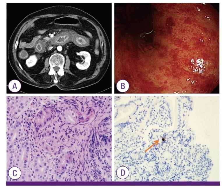 https://cdn.ncbi.nlm.nih.gov/pmc/blobs/0a6f/5500272/3aedbfc51280/ic-49-146-g002.jpg