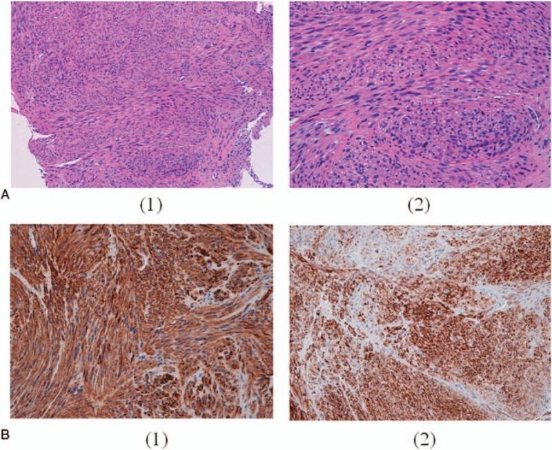 https://cdn.ncbi.nlm.nih.gov/pmc/blobs/0a74/5690758/62ee9b4d2821/medi-96-e8545-g002.jpg