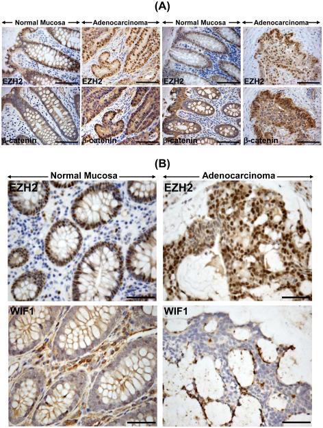 https://cdn.ncbi.nlm.nih.gov/pmc/blobs/0a78/4459936/e6fa11ce9084/nihms-635673-f0006.jpg