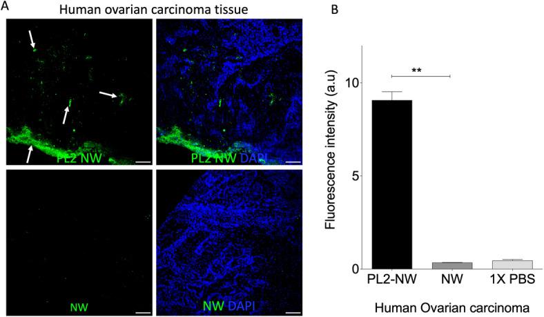 https://cdn.ncbi.nlm.nih.gov/pmc/blobs/0a82/12340053/dfb463f1f4bf/41598_2025_11299_Fig5_HTML.jpg
