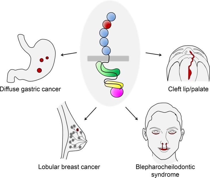 https://cdn.ncbi.nlm.nih.gov/pmc/blobs/0a86/6581119/8ccb42b99754/jmedgenet-2018-105807f03.jpg