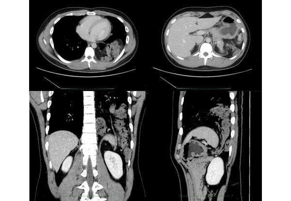 https://cdn.ncbi.nlm.nih.gov/pmc/blobs/0a8c/3000846/df5852bd689b/1752-1947-4-366-2.jpg