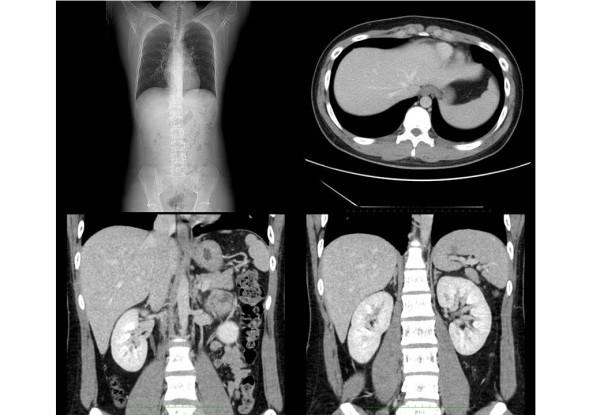 https://cdn.ncbi.nlm.nih.gov/pmc/blobs/0a8c/3000846/ebf30a38fe89/1752-1947-4-366-5.jpg