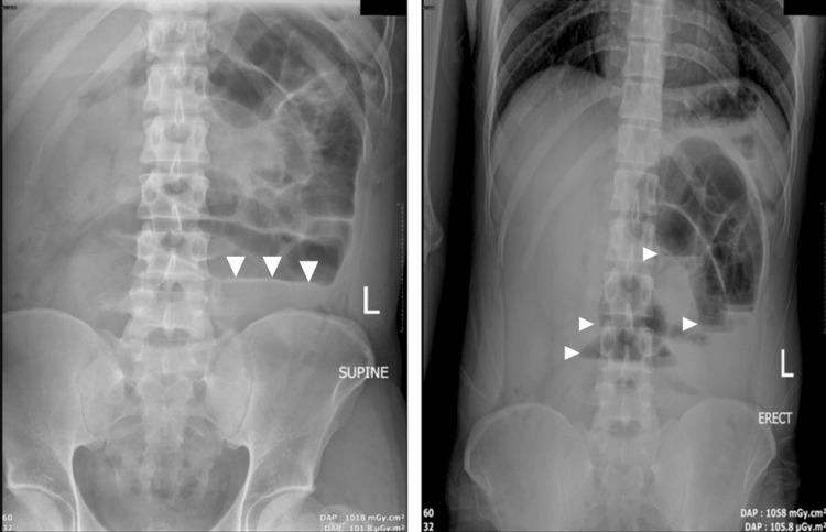 https://cdn.ncbi.nlm.nih.gov/pmc/blobs/0a90/12137200/7083aeb0760e/cureus-0017-00000083540-i01.jpg