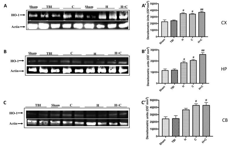 https://cdn.ncbi.nlm.nih.gov/pmc/blobs/0a92/8228340/0af1c5075295/antioxidants-10-00898-g008.jpg