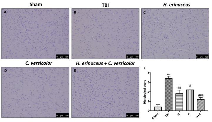 https://cdn.ncbi.nlm.nih.gov/pmc/blobs/0a92/8228340/39f2c309d9a2/antioxidants-10-00898-g002.jpg