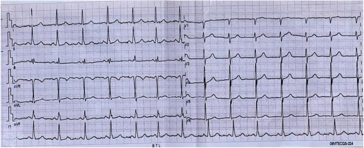 https://cdn.ncbi.nlm.nih.gov/pmc/blobs/0a94/12008165/2f3ed5d2cee2/CCR3-13-e70451-g001.jpg
