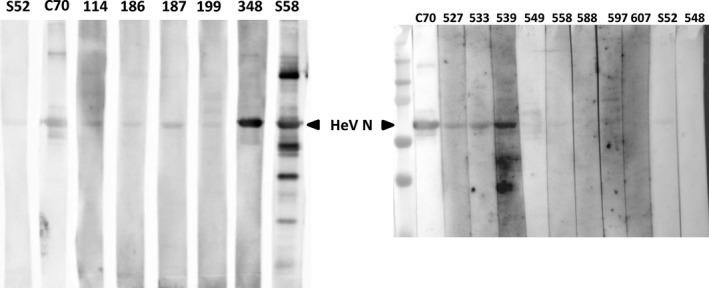 https://cdn.ncbi.nlm.nih.gov/pmc/blobs/0a95/6849855/398b547535a5/TBED-66-921-g003.jpg