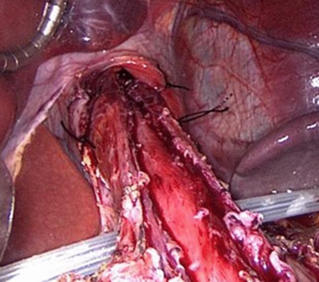 https://cdn.ncbi.nlm.nih.gov/pmc/blobs/0a98/10017584/d9fc37f0e28e/464_2022_9696_Fig1_HTML.jpg