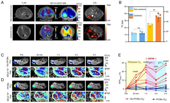 https://cdn.ncbi.nlm.nih.gov/pmc/blobs/0a98/12274189/cda896d39982/ijo-67-02-05776-g01.jpg