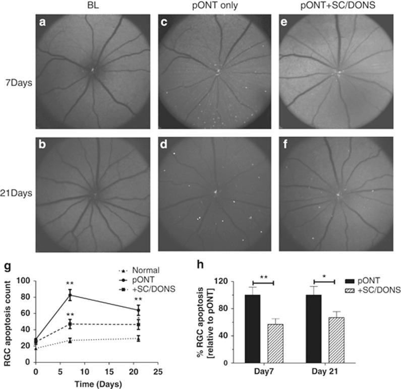 https://cdn.ncbi.nlm.nih.gov/pmc/blobs/0a9a/4237238/7109ecfef5e0/cddis2014399f2.jpg