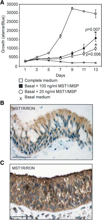 https://cdn.ncbi.nlm.nih.gov/pmc/blobs/0a9a/4343068/9d55351eced9/12931_2014_160_Fig11_HTML.jpg