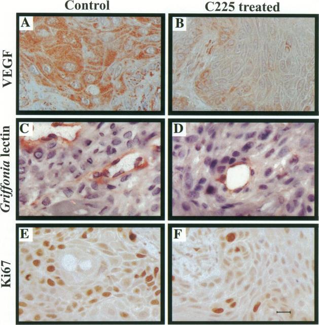 https://cdn.ncbi.nlm.nih.gov/pmc/blobs/0a9b/1858348/75ed356110a6/amjpathol00024-0032-a.jpg