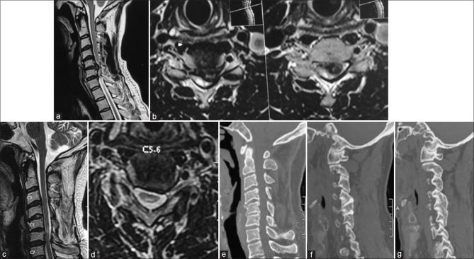 https://cdn.ncbi.nlm.nih.gov/pmc/blobs/0a9c/11029116/53b69f77b494/JCVJS-15-74-g002.jpg