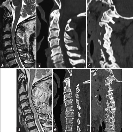https://cdn.ncbi.nlm.nih.gov/pmc/blobs/0a9c/11029116/ad528c14d2b0/JCVJS-15-74-g003.jpg