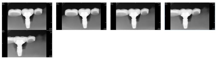 https://cdn.ncbi.nlm.nih.gov/pmc/blobs/0aa3/12292619/8ddc1764ccc4/bioengineering-12-00772-g005.jpg
