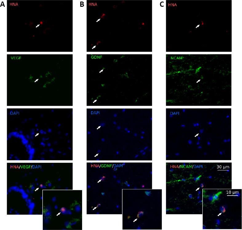 https://cdn.ncbi.nlm.nih.gov/pmc/blobs/0aa5/7996027/57aed80807a5/NRR-16-550-g010.jpg