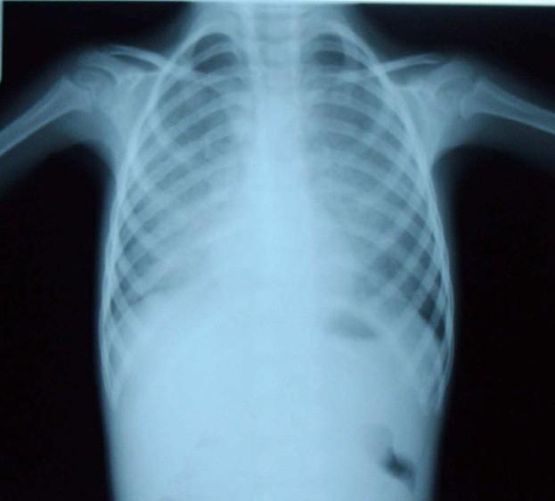 https://cdn.ncbi.nlm.nih.gov/pmc/blobs/0aab/3082791/82acf6f3ac55/JRMS-15-120-g001.jpg