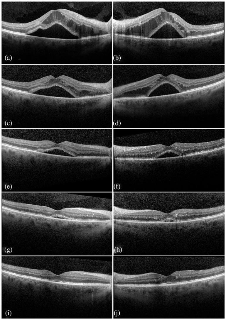 https://cdn.ncbi.nlm.nih.gov/pmc/blobs/0aab/6329023/8d439b9202da/10.1177_2515841418820441-fig2.jpg