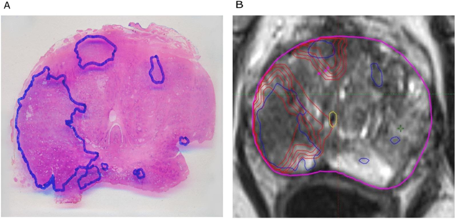 https://cdn.ncbi.nlm.nih.gov/pmc/blobs/0ab1/8976981/14047c8f6b59/13014_2022_2035_Fig1_HTML.jpg