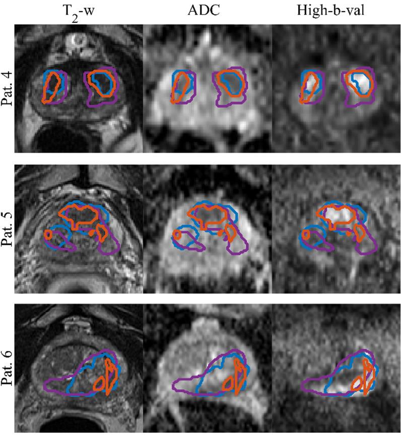 https://cdn.ncbi.nlm.nih.gov/pmc/blobs/0ab1/8976981/33141108cdb2/13014_2022_2035_Fig5_HTML.jpg